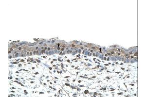 CENPA antibody was used for immunohistochemistry at a concentration of 4-8 ug/ml. (CENPA antibody  (N-Term))
