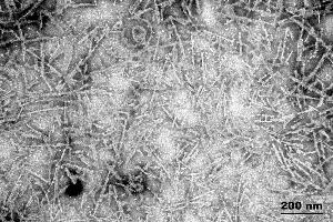 Electron Microscopy (EM) image for tau Protein (full length), (Pro301Ser-Mutant) (Active) protein (ABIN6929397)