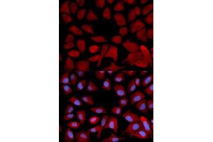Immunofluorescence analysis of U2OS cells using PSMC4 antibody. (PSMC4 antibody  (AA 1-165))