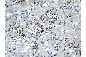SCD antibody was used for immunohistochemistry at a concentration of 4-8 ug/ml to stain Hepatocytes (arrows) in Human liver. (SCD antibody)