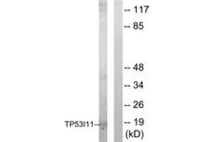 Western blot analysis of extracts from HuvEc cells, using TP53I11 Antibody. (TP53I11 antibody  (AA 71-120))