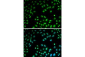 Immunofluorescence analysis of U2OS cells using PI antibody (ABIN6128449, ABIN6145593, ABIN6145595 and ABIN6221396). (PIAS1 antibody  (AA 422-651))