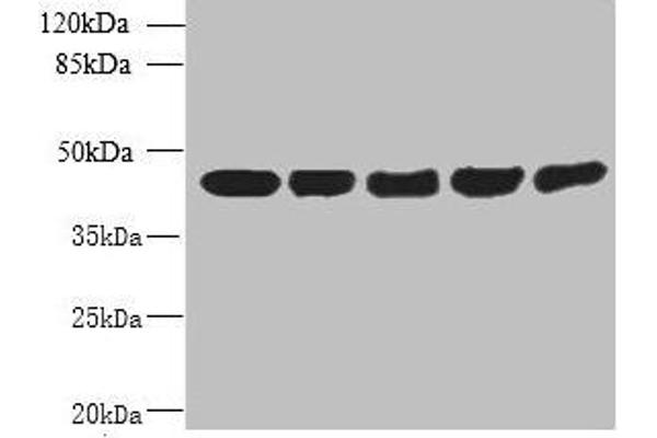 ARPM1 Antikörper  (AA 1-372)
