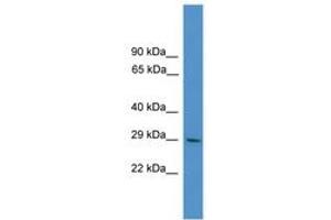 Image no. 1 for anti-Zinc Finger Protein 688 (ZNF688) (AA 121-170) antibody (ABIN6745399) (ZNF688 antibody  (AA 121-170))