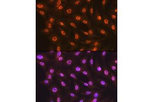 Immunofluorescence (IF) image for anti-Splicing Factor 3b, Subunit 1, 155kDa (SF3B1) antibody (ABIN7270542)