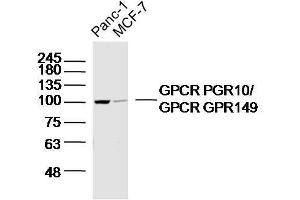 Lane 1: panc-1 lysates Lane 2: MCF-7 lysates probed with GPCR PGR10/GPCR GPR149 Polyclonal Antibody, Unconjugated  at 1:300 dilution and 4˚C overnight incubation.