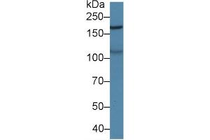 Detection of MAST2 in Porcine Cerebrum lysate using Polyclonal Antibody to Microtubule Associated Serine/Threonine Kinase 2 (MAST2) (MAST2 antibody  (AA 512-785))
