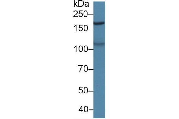 MAST2 Antikörper  (AA 512-785)