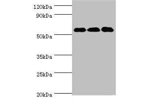 Western blot All lanes: XIAP antibody at 3 μg/mL Lane 1: HepG2 whole cell lysate Lane 2: MCF-7 whole cell lysate Lane 3: PC-3 whole cell lysate Secondary Goat polyclonal to rabbit IgG at 1/10000 dilution Predicted band size: 57 kDa Observed band size: 57 kDa (XIAP antibody  (AA 1-200))