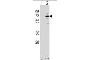 Western blot analysis of MeCP2 (arrow) using rabbit polyclonal MeCP2 Antibody (E11) (ABIN650708 and ABIN2839305).