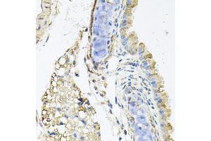 Immunohistochemistry of paraffin-embedded mouse lung using CTSK antibody (ABIN5970899) at dilution of 1/100 (40x lens). (Cathepsin K antibody)
