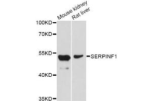 Western blot analysis of extracts of various cell lines, using SERPINF1 Antibody (ABIN5998782) at 1/1000 dilution.