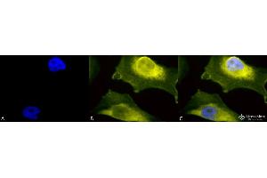 Immunocytochemistry/Immunofluorescence analysis using Rabbit Anti-SOD1 (UBB) Polyclonal Antibody . (SOD1 antibody  (N-Term))