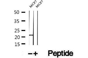 Western blot analysis of extracts of MCF7 cells, using PTP4A1/PRL1 antibody. (PTP4A1 antibody  (C-Term))