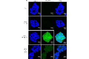 Effect of OXY on mRNA and protein expression of MUC2.