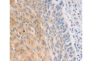 Immunohistochemistry (IHC) image for anti-Mucin 5 Subtype B (MUC5B) antibody (ABIN2426704) (MUC5B antibody)
