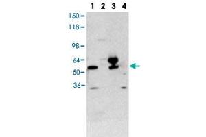Western blot using THRA polyclonal antibody  shows detection of purified recombinant THRA (lane 1) and THRA present in a 293 cell lysate after transient transfection with THRA (lane 3). (THRA antibody  (N-Term))