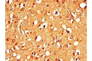 Immunohistochemistry of paraffin-embedded human brain tissue using ABIN7170837 at dilution of 1:100 (Stim2 antibody  (AA 471-656))