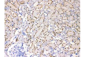IHC analysis of ADK using anti- ADK antibody . (ADK antibody  (AA 165-351))
