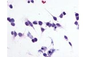 Immunocytochemistry (ICC) image for anti-Purinergic Receptor P2Y, G-Protein Coupled, 1 (P2RY1) (C-Term) antibody (ABIN1049199)