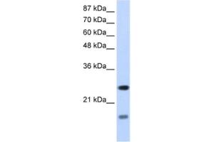 Western Blotting (WB) image for anti-Signal Recognition Particle 14kDa (Homologous Alu RNA Binding Protein) (SRP14) antibody (ABIN2462140) (SRP14 antibody)