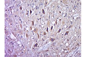 Paraformaldehyde-fixed, paraffin embedded rat brain, Antigen retrieval by boiling in sodium citrate buffer (pH6. (DAXX antibody  (pSer213))
