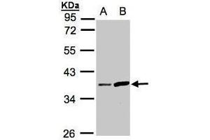 WB Image Sample(30 ug whole cell lysate) A:HeLa S3, B:Raji , 10% SDS PAGE antibody diluted at 1:1000 (PRSS8 antibody  (Center))