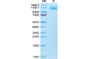 Biotinylated SARS-COV-2 Spike S1 (Omicron B. (SARS-CoV-2 Spike S1 Protein (B.1.1.529 - Omicron) (His-Avi Tag,Biotin))