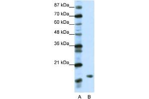 WB Suggested Anti-DR1 Antibody Titration:  1. (DR1 antibody  (N-Term))