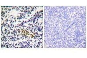 Immunohistochemistry analysis of paraffin-embedded human tonsil tissue using NYREN18 antibody.