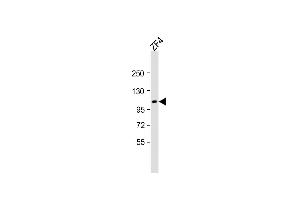 Anti-ROBO1 Antibody at 1:2000 dilution + ZF4 whole cell lysate Lysates/proteins at 20 μg per lane. (TEK antibody  (N-Term))