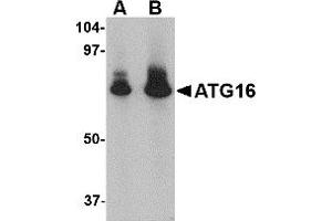 Western Blotting (WB) image for anti-ATG16 Autophagy Related 16-Like 1 (ATG16L1) (N-Term) antibody (ABIN1031245) (ATG16L1 antibody  (N-Term))