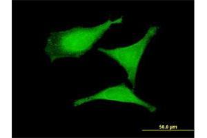 Immunofluorescence of purified MaxPab antibody to CGRRF1 on HeLa cell. (CGR19 antibody  (AA 1-332))