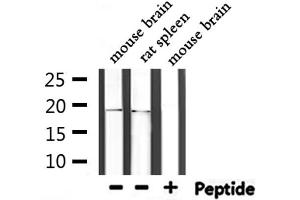 Western blot analysis of extracts from mouse brain,rat spleen, using UBE2I  Antibody. (UBE2I antibody  (N-Term))