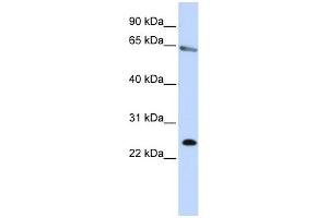 WB Suggested Anti-ZNF326 Antibody Titration:  0. (ZNF326 antibody  (N-Term))