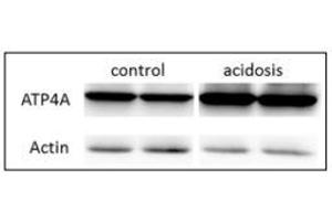 resentative western blot images of ATP4A, right panel is the quantification of the ratio of ATP4A on actin signals. (ATP4A antibody  (AA 786-1014))