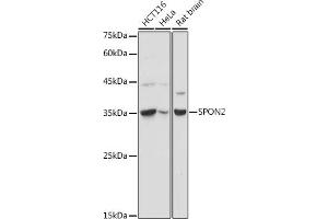 Western blot analysis of extracts of various cell lines, using SPON2 antibody (ABIN6129679, ABIN6148370, ABIN6148372 and ABIN6215647) at 1:1000 dilution. (SPON2 antibody  (AA 27-150))