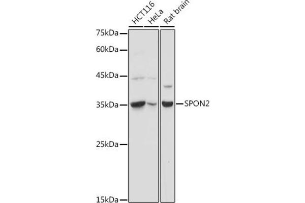 SPON2 抗体  (AA 27-150)