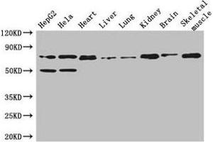 Western Blot Positive WB detected in: HepG2 whole cell lysate, Hela whole cell lysate, Mouse heart tissue, Mouse liver tissue, Mouse lung tissue, Mouse kidney tissue, Mouse brain tissue, Mouse skeletal muscle tissue All lanes: COL8A1 antibody at 3 μg/mL Secondary Goat polyclonal to rabbit IgG at 1/50000 dilution Predicted band size: 74 kDa Observed band size: 74 kDa (COL8A1 antibody  (AA 572-744))