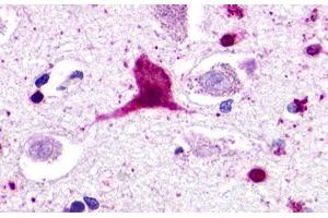 Image no. 1 for anti-G Protein-Coupled Receptor 62 (GPR62) (Cytoplasmic Domain) antibody (ABIN1048850) (GPR62 antibody  (Cytoplasmic Domain))
