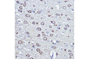Immunohistochemistry (IHC) image for anti-NFS1, Cysteine Desulfurase (NFS1) (AA 208-457) antibody (ABIN6144595)