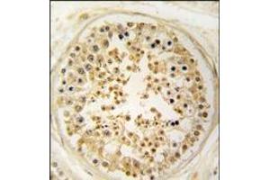 Formalin-fixed and paraffin-embedded human testis tissue reacted with EARS2 antibody (C-term), which was peroxidase-conjugated to the secondary antibody, followed by DAB staining.