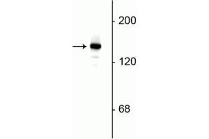 Western blot of rat hippocampal lysate showing specific immunolabeling of the ~145 kDa synaptojanin I protein. (Synaptojanin 1 antibody  (C-Term))