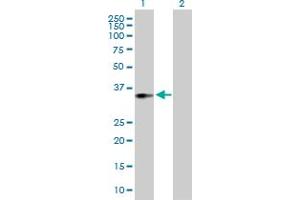 Western Blot analysis of ACOT8 expression in transfected 293T cell line by ACOT8 MaxPab polyclonal antibody. (ACOT8 antibody  (AA 1-319))