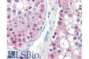 ABIN571107 (5µg/ml) staining of paraffin embedded Human Testis. (DYDC1 antibody  (AA 142-154))