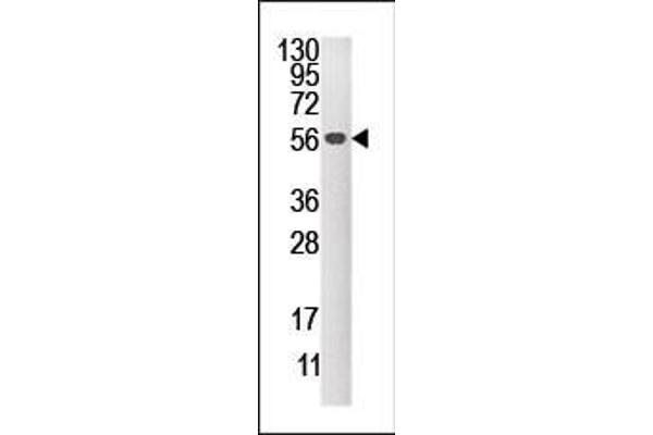 DUSP4 antibody  (C-Term)