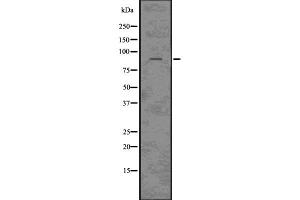 Western blot analysis of CLCN3 using HepG2 whole cell lysates (CLCN3 antibody  (N-Term))
