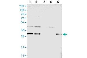 Western blot analysis of Lane 1: RT-4, Lane 2: U-251 MG, Lane 3: Human Plasma, Lane 4: Liver, Lane 5: Tonsil with TMEM17 polyclonal antibody  at 1:250-1:500 dilution. (TMEM17 antibody)