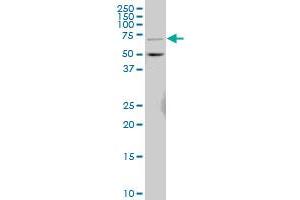 CERK polyclonal antibody (A01), Lot # ABNOVA060329QCS1 Western Blot analysis of CERK expression in IMR-32 . (CERK antibody  (AA 1-201))