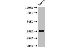 Western Blot Positive WB detected in: Rat brain tissue All lanes: Metrnl antibody at 3 μg/mL Secondary Goat polyclonal to rabbit IgG at 1/50000 dilution Predicted band size: 35, 36 kDa Observed band size: 35 kDa (METRNL antibody  (AA 46-311))